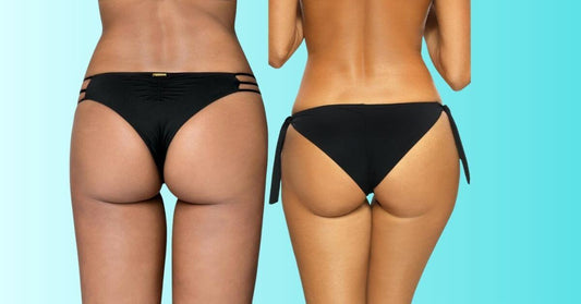 Sexy Μπραζίλ: Η τάση που έγινε το απόλυτο must - Blog Sexy Εσώρουχα - E-string.gr